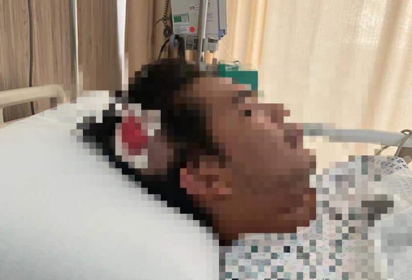 Tegur Pemandu Tak Bagi Signal, Lelaki Dibelasah Hingga Patah 7 Gigi Di Kota Kinabalu