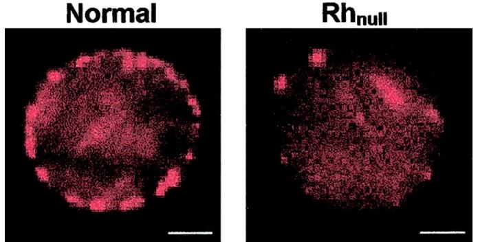rhnull rarest blood group world 7 Ciri-Ciri Unik Tubuh Badan Yang Anda Mungkin Ada Tetapi Tidak Dimiliki Oleh Orang Lain