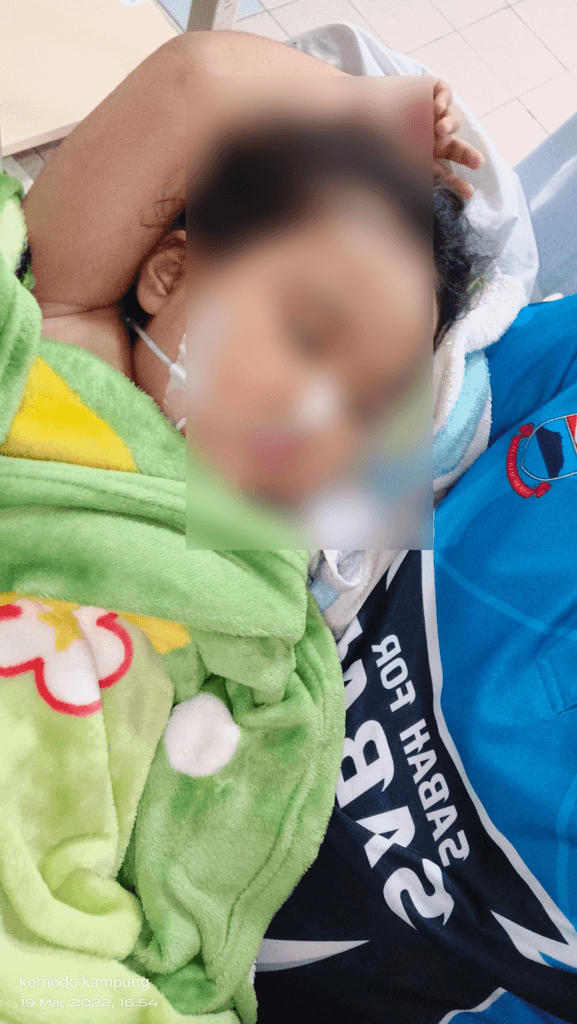 Kanak-Kanak 5 Tahun Di Sabah Diuji Kanser Pangkal Otak, Bapa Rayu Bantuan Seikhlas Hati