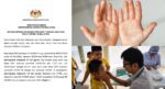 Semakin Mengganas, Ini Yang Perlu Dilakukan Ibu Bapa Sekiranya Anak-Anak Dijangkiti HFMD