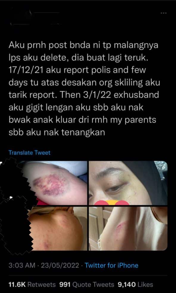 Gigit Isteri Sebab Berang Guna Duit BKSS Beli Susu Anak, Suami Dayus Di Kuching Kini Diberkas Polis