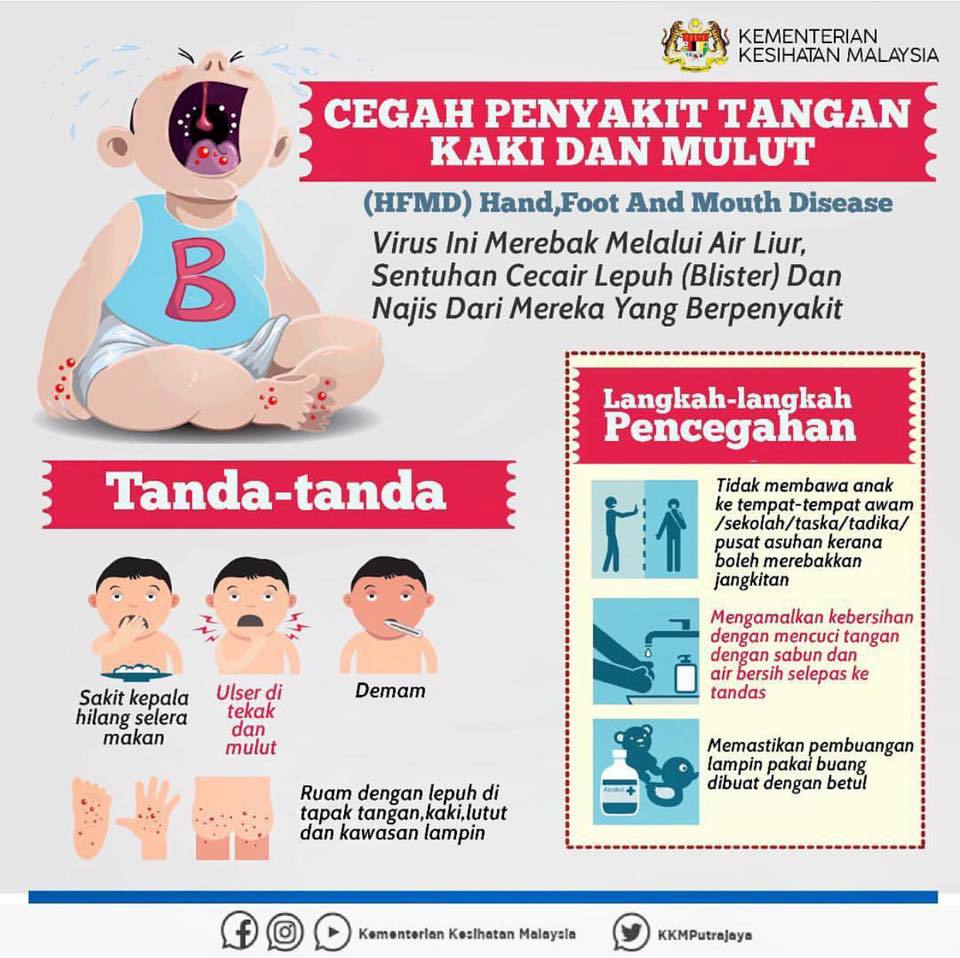 Semakin Mengganas, Ini Yang Perlu Dilakukan Ibu Bapa Sekiranya Anak-Anak Dijangkiti HFMD