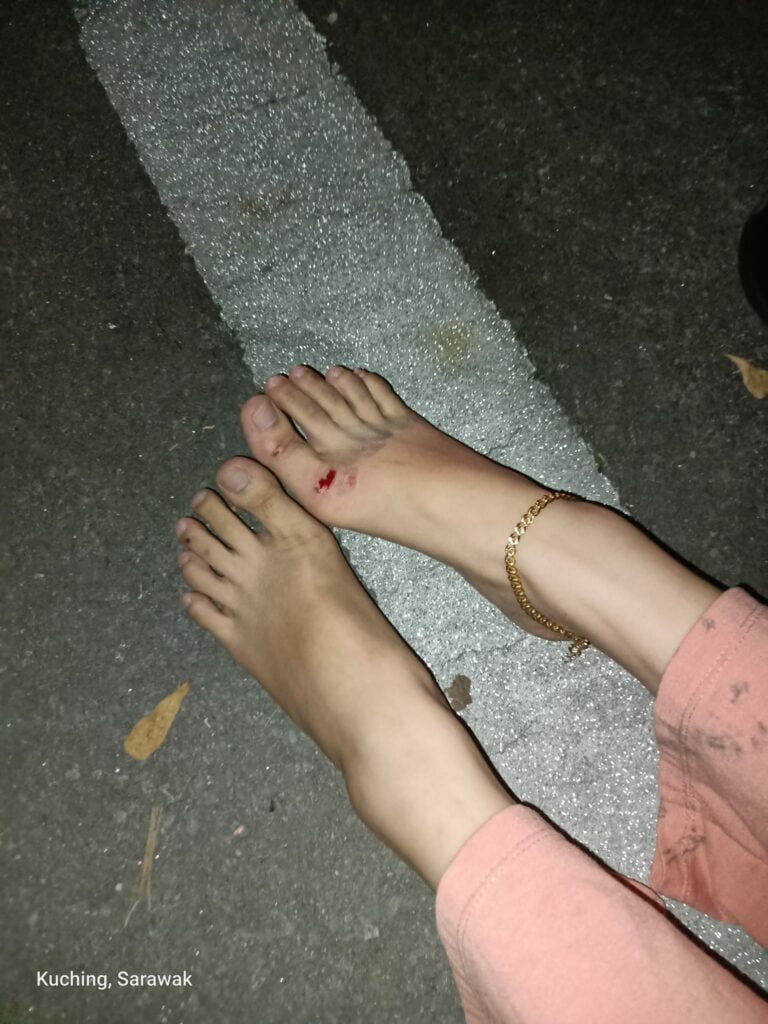 Gadis Diraba Sehingga Kemalangan Koyak Dagu Di Kuching, Lelaki Helmet Pink Kini Diburu