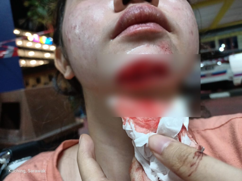 Gadis Diraba Sehingga Kemalangan Koyak Dagu Di Kuching, Lelaki Helmet Pink Kini Diburu