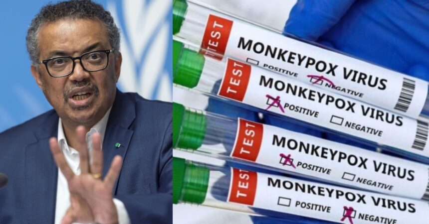 Lebih 16,000 Kes Cacar Monyet-WHO Mengisytiharkan Kecemasan Global