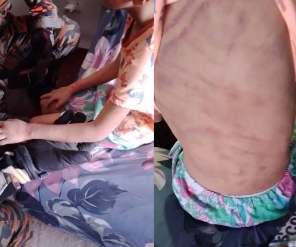 Jadi Mangsa Dera, Budak Lelaki Lari Ikut Tingkap Tingkat 4 Bangunan Rumah