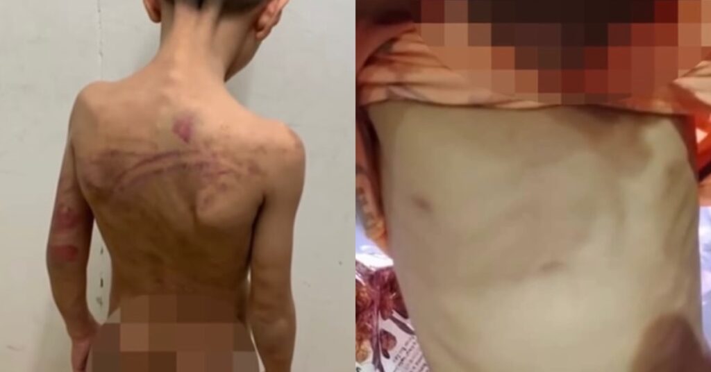 Jadi Mangsa Dera, Budak Lelaki Lari Ikut Tingkap Tingkat 4 Bangunan Rumah