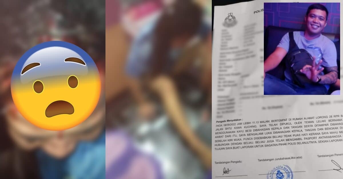 Luka Teruk Bahagian Kepala, Lelaki Niat Bunuh Teman Wanitanya Kini Diburu Polis