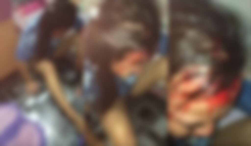 Luka Teruk Bahagian Kepala, Lelaki Pukul Teman Wanita Kini Diburu Polis Di Kuching