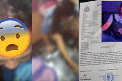 Luka Teruk Bahagian Kepala, Lelaki Niat Bunuh Teman Wanitanya Kini Diburu Polis