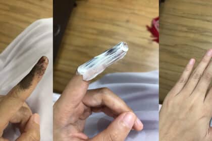 Buang Dakwat Mengundi Pada Jari Dalam Masa 10 Minit, Ini Cara Buatnya