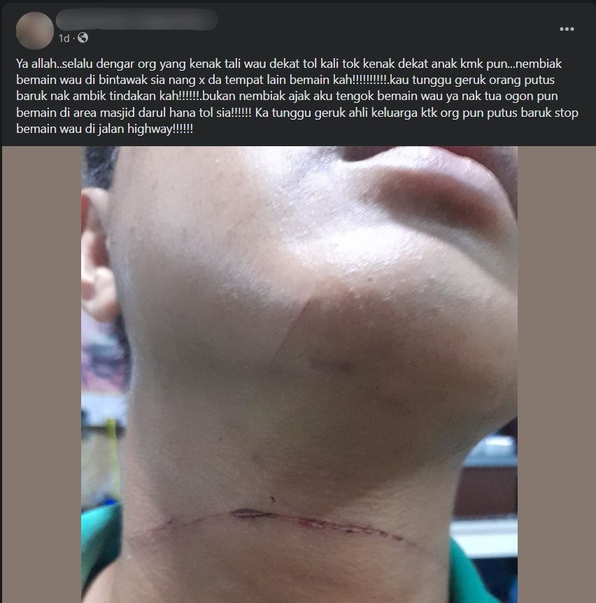 Ramai Terkena, Tali 'Gudi' Bersepah Hampir Jerut Leher Di Kawasan Masjid Darul Hana