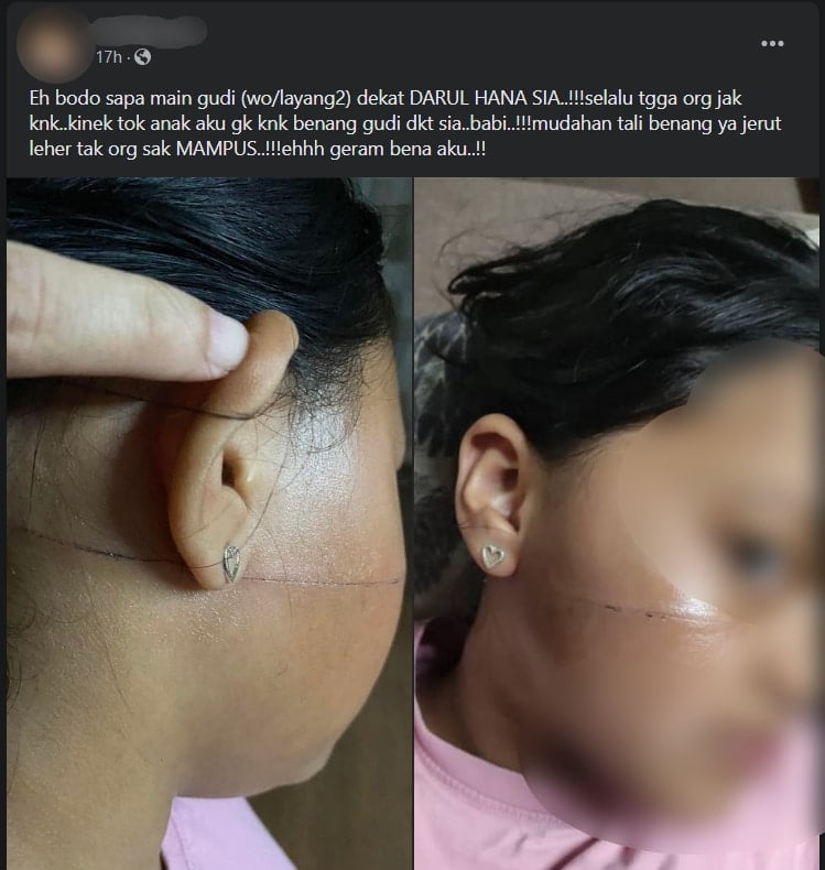Ramai Terkena, Tali 'Gudi' Bersepah Hampir Jerut Leher Di Kawasan Masjid Darul Hana