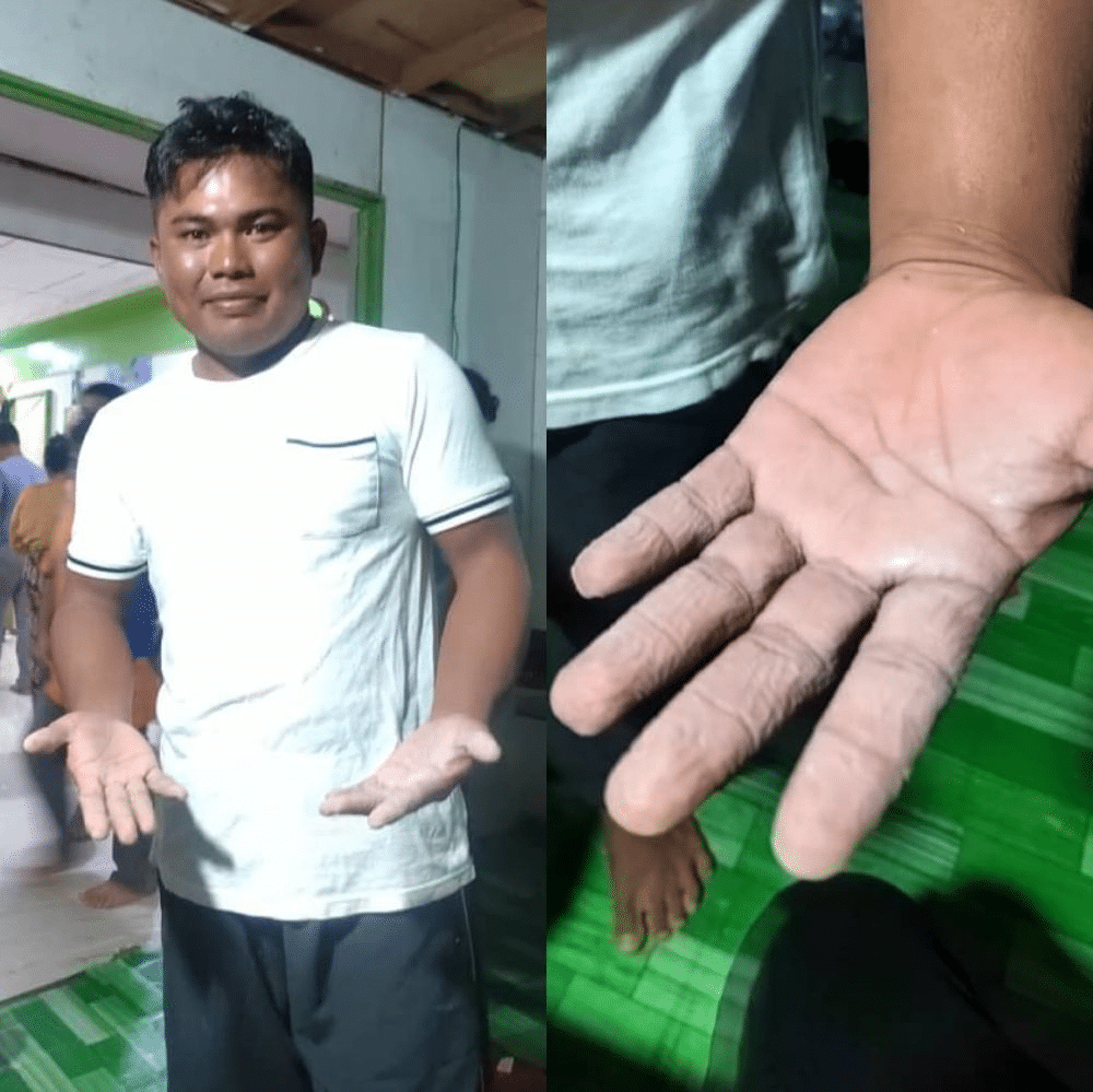 14 Jam Berenang Redah Ombak Setelah Jatuh Bot, Nelayan Dari Sabah Ini Berjaya Selamatkan Diri