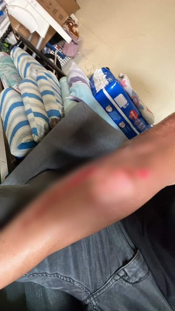 Gara-gara Jalan Berlapis Dan Diturap Ala Kadar, Lelaki Ini Kongsi Jadi Mangsa Kemalangan Di Samarahan