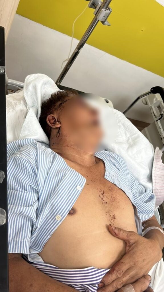 Kini Diburu Pihak Polis, Pekerja Warga Indonesia Pukul Warga Emas Di Kedai Kopi Kuching