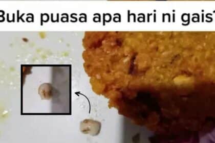 Trauma Beli Makanan Di Bazar, Wanita Terkejut Temui 'Gigi Berlubang' Dalam Kuih Vadai