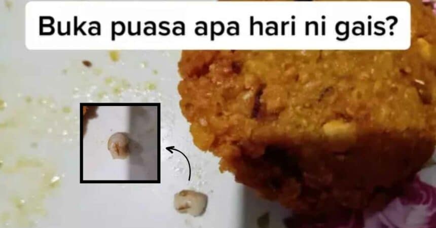 Trauma Beli Makanan Di Bazar, Wanita Terkejut Temui 'Gigi Berlubang' Dalam Kuih Vadai