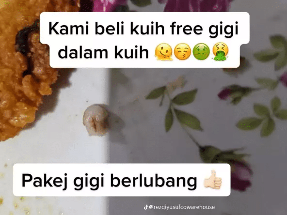 Trauma Beli Makanan Di Bazar, Wanita Terkejut Temui 'Gigi Berlubang' Dalam Kuih Vadai