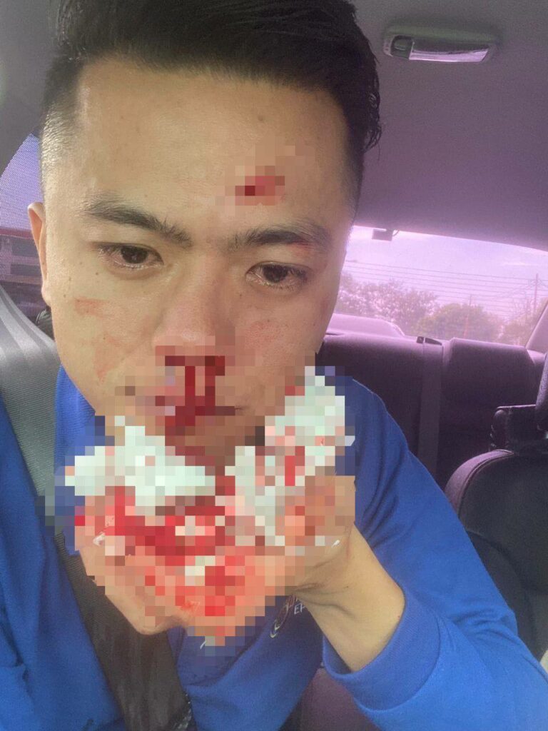 Gara-Gara Tegur Tak Bagi Signal, Lelaki Ditumbuk Hingga Cedera Oleh Pemandu Saga Di Labuan