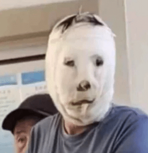 Balutan Muka Jadi Bahan Gurauan, Pesakit Mahu Saman Doktor