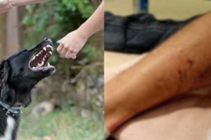 Tindakan Pantas Mampu Selamatkan Nyawa, Ini Perkara Anda Perlu Buat Jika Digigit Anjing Liar