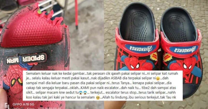 Wanita Kongsi Kisah Trauma Kaki Anak Hampir Tersepit Eskalator Gara-Gara Guna Selipar Getah