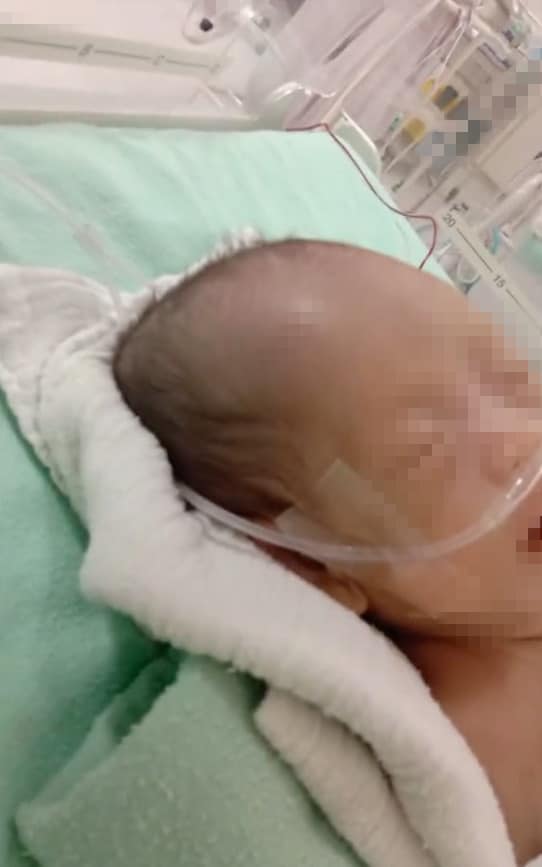 Lagi Kes Hospital Cuai, Bayi 2 Bulan Alami Pendarahan Otak Akibat Terjatuh