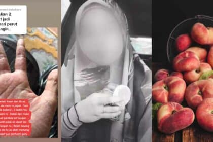 'Muka Pedih Dan Nafas Sesak', Wanita Kongsi Nyawa Hampir Melayang Lepas Makan Donut Peach Viral