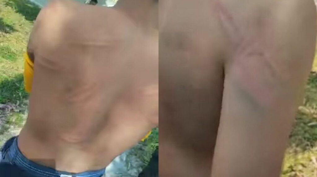 Bukan Isu Bayar Gaji, 2 Individu Dipukul Dengan Cota Gara-Gara Hantar Video Lucah Kepada Wanita
