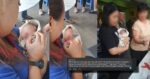Hampir Dihurung Ulat, Bayi Dalam Plastik Ditemui Pekerja Lori Sampah Di Batu Kawa