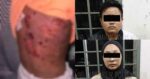 Jadi Mangsa Dera Ibu Kandung Dan 'Bapa' Pengkid, Jiran Dedah Dengar Jeritan Sejak 2 Minggu Lepas