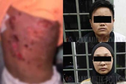 Jadi Mangsa Dera Ibu Kandung Dan 'Bapa' Pengkid, Jiran Dedah Dengar Jeritan Sejak 2 Minggu Lepas