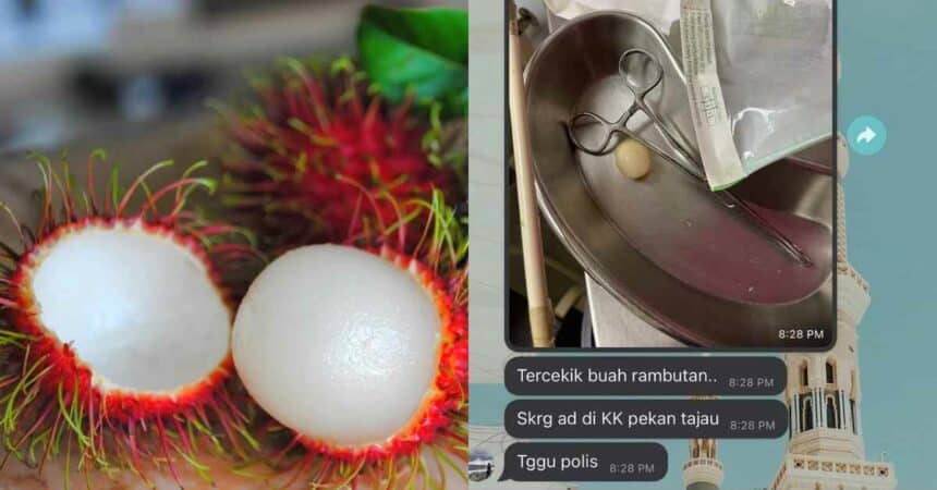 Kanak-Kanak 9 Tahun Temui Ajal Gara-Gara Tercekik Rambutan