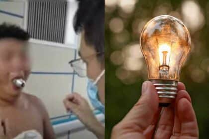 Lelaki Tersiksa, Mentol Lampu Tersekat Dalam Mulut Lebih Dua Jam