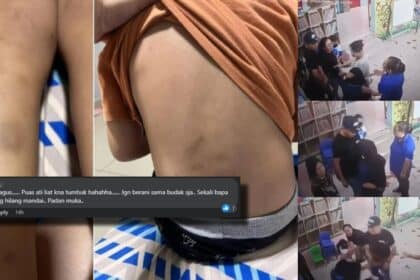 Netizen Puas Hati, Bapa Serang Pengasuh Dera Anaknya Di Sabah Pula Tular