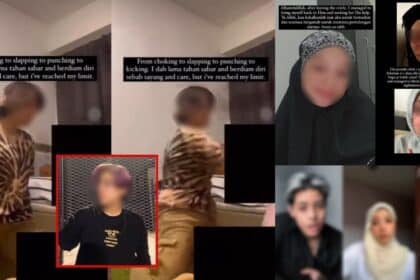 Pernah Digelar Billie Eilish Malaysia Dan Mengaku Ada 20 Identiti, Kini Tular Lagi Sebab Pukul Teman Wanita