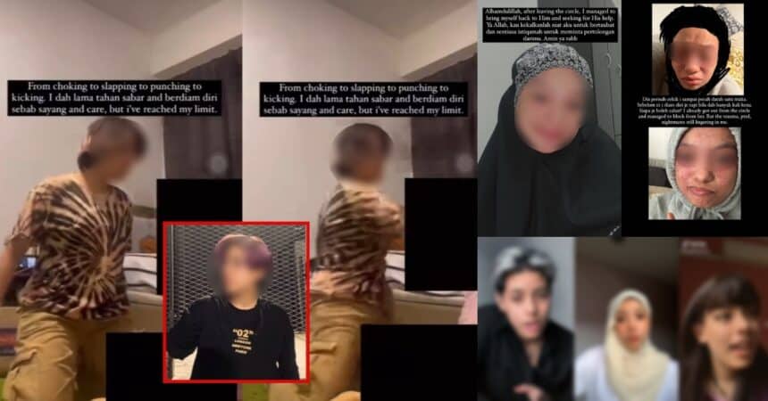 Pernah Digelar Billie Eilish Malaysia Dan Mengaku Ada 20 Identiti, Kini Tular Lagi Sebab Pukul Teman Wanita