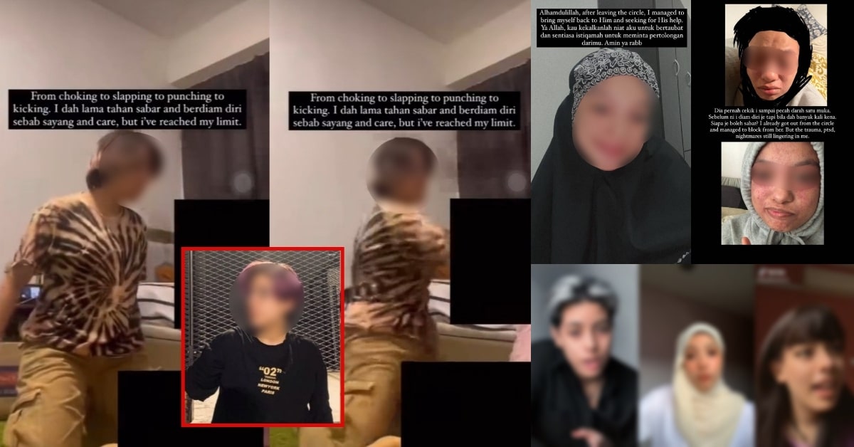 Pernah Digelar Billie Eilish Malaysia Dan Mengaku Ada 20 Identiti, Kini Tular Lagi Sebab Pukul Teman Wanita