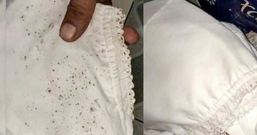 Jangan Buang Pakaian Bertahi Lalat, Ini 5 Petua Mudah Hilangkan Tahi Lalat Pada Pakaian