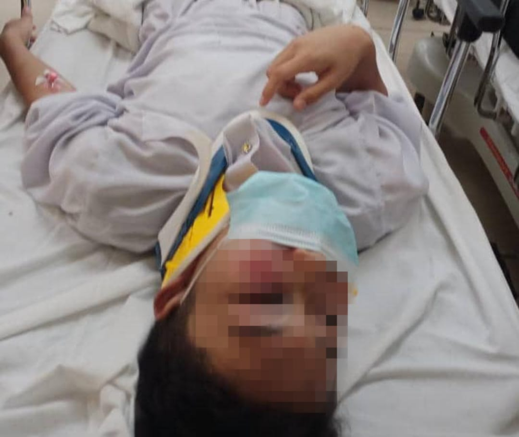 Gara-Gara Malas Bergaduh, Pelajar Dibelasah Hingga Lebam Di Sebuah Sekolah Di Kuching