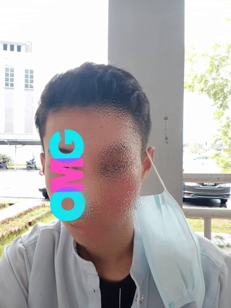 Gara-Gara Malas Bergaduh, Pelajar Dibelasah Hingga Lebam Di Sebuah Sekolah Di Kuching