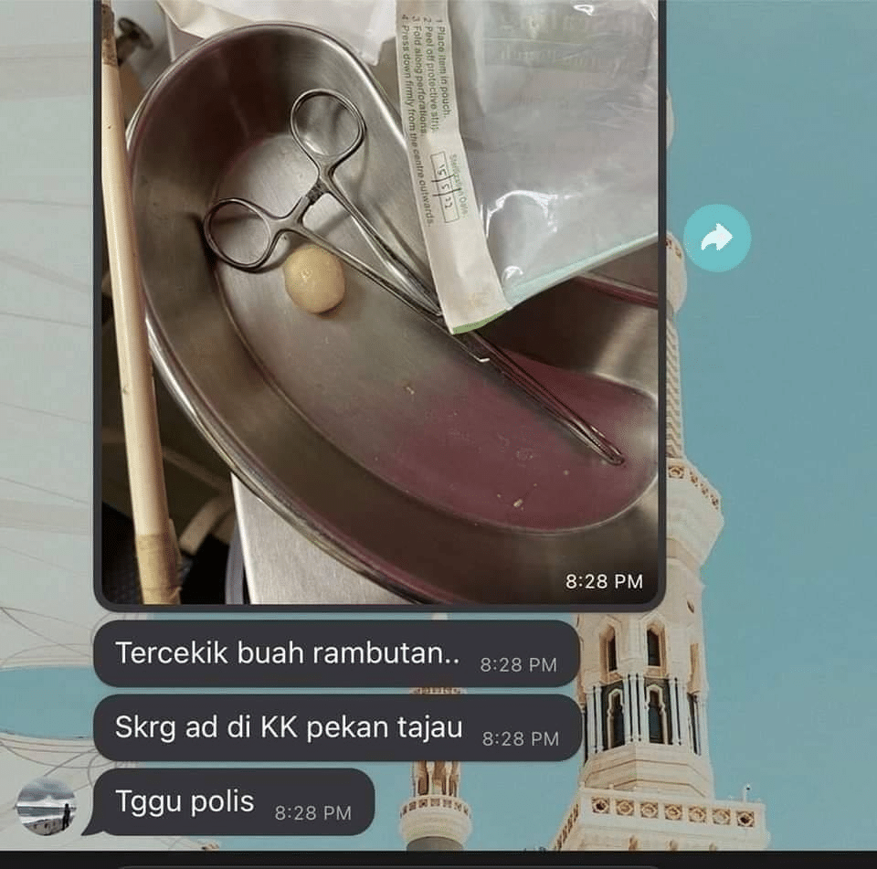 Kanak-Kanak 9 Tahun Temui Ajal Gara-Gara Tercekik Rambutan