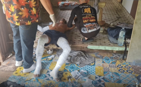 Niat Nak Bakar Rumah Jiran Tak Kesampaian, Lelaki Melecur Separuh Badan Ketika Simbah Petrol