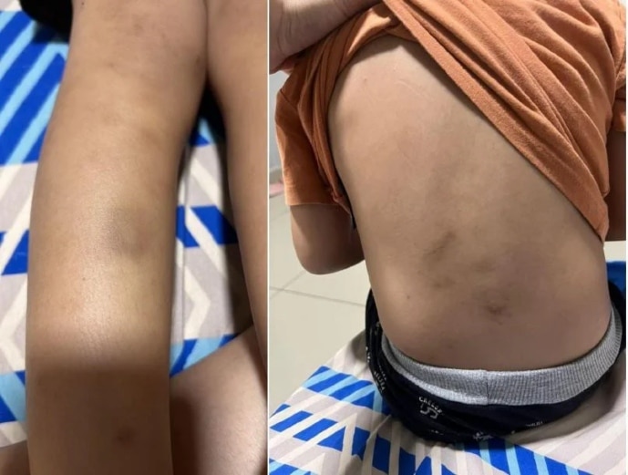 Netizen Puas Hati, Bapa Serang Pengasuh Dera Anaknya Di Sabah Pula Tular
