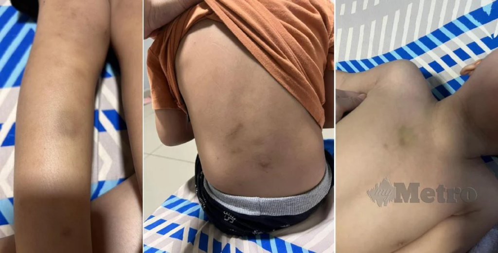 Tendang, Lempang Dan Tarik Rambut Budak 4 Tahun, Pengasuh Taska Kini Ditahan