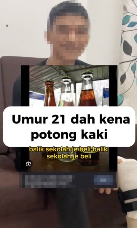 Ketagih Air Berkarbonat, Kaki Lelaki Usia 21 Tahun Kena Potong
