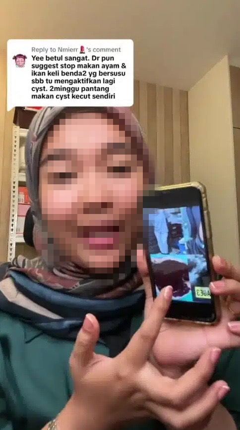 Gemar Makan Ayam Setiap Hari, Wanita Menghidapi Cyst Stage 3 Dan Hampir Operate RM30K