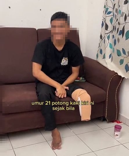 Ketagih Air Berkarbonat, Kaki Lelaki Usia 21 Tahun Kena Potong