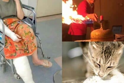 Niat Masak Makanan Kucing Bertukar Tragedi, Wanita Hamil 7 Bulan Melecur Disambar Api